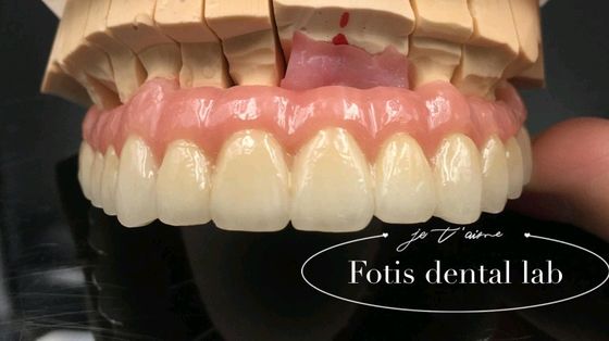 Good price Reliable Restoration PFM Dental Crowns Porcelain Fused To Metal Crown Customized online