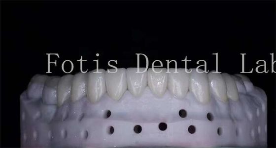 Good price OEM ODM Stain Resistant Natural Looking Porcelain Veneers High Strength online
