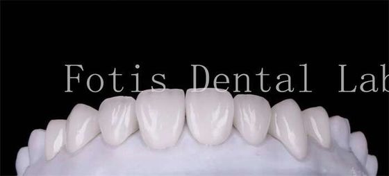 Good price Polishing Finishing Cosmetic Teeth Veneer Covers  For Beautiful Smile online
