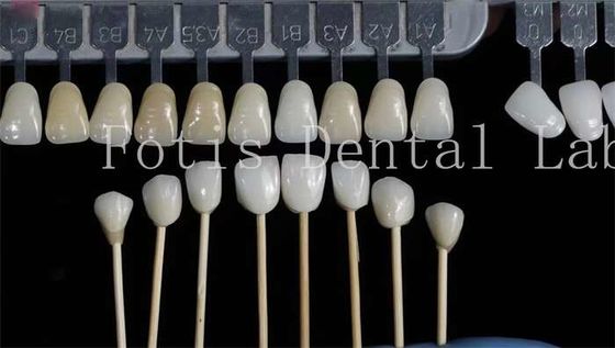 Good price Customization Natural Dental Veneers Fake Teeth Overlays High Strength online