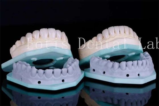 Good price Stain Resistant Dental Teeth Veneers Dental Clinic Veneers 0.3mm-0.5mm Thickness online