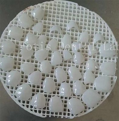 Good price Upgrade Your Polishing Game with Smooth Surface Texture Cosmetic Teeth Covers online
