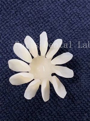 Stain Resistant Dental Porcelain Veneers High Strength for Optimal Results