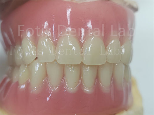 Good price Comfort Custom Fit Full Acrylic Denture For Precise Dental Prosthesis online
