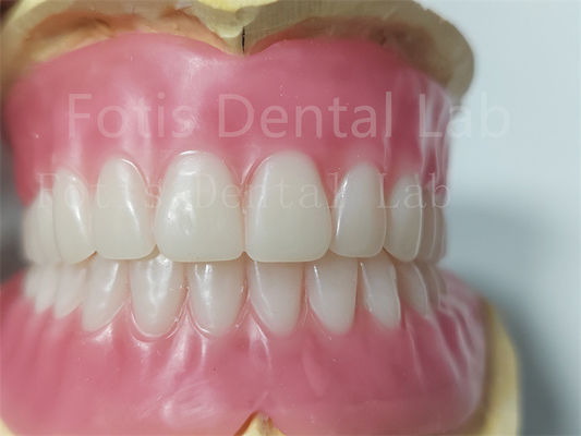 Good price Durable Natural Color Full Acrylic Denture Odorless Customization online