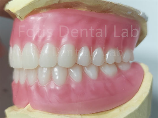 Good price OEM Full Upper And Lower Acrylic Denture Stain Resistance  Natural Color online