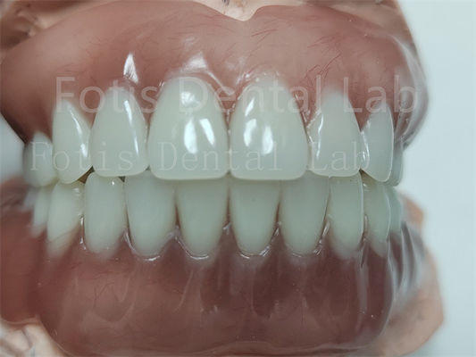 Good price Comfortable Full Upper Acrylic Denture Complete Acrylic Denture With Ivoclar Teeth online