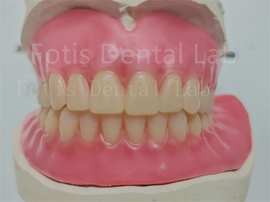 Good price Affordable Custom Full Acrylic Denture With Ivoclar Teeth Easy To Use online