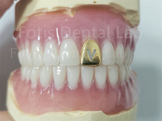 Good price Comfortable Precision Fit Full Acrylic Denture Prosthesis With Natural Teeth online