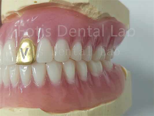 Good price Customizable Full Denture Acrylic Teeth Odor Resistant Comfort Fit online