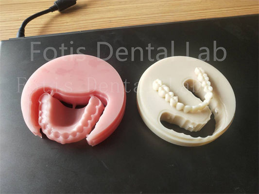 Good price Comfort Fit Full Acrylic Dental Prosthesis For Professional Technicians Easy To Clean online