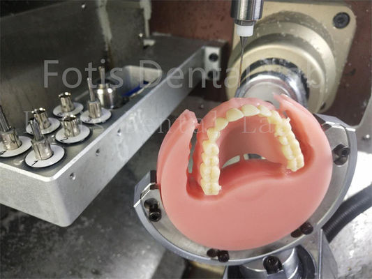 Good price Ivoclar Natural Color Full Acrylic Denture Comfort Fit Prosthesis With Esthetics online