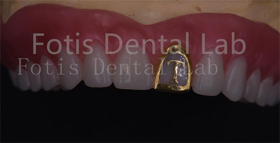 Good price OEM Natural Full Acrylic Denture Ivoclar Teeth Stain Resistance online