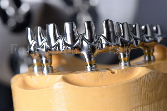 Good price Long Lasting Titanium / Zirconia All On 4 All On 6 Implants No Age Limit online