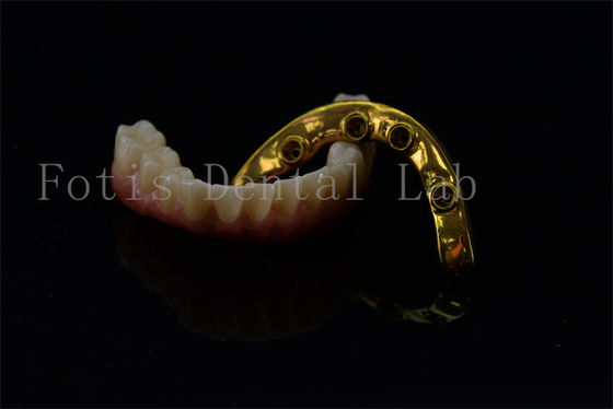 Good price Titanium Zirconia All On 4 All On 6 Implants Full Smile Implants Lifetime Warranty online
