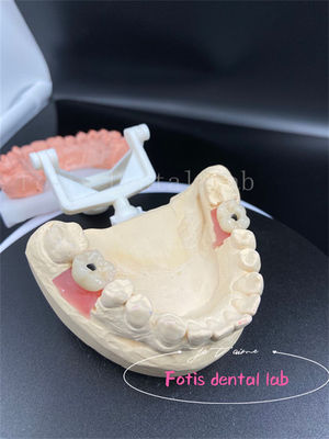 Good price Precision Fit Full Mouth Dental Crowns Easy Placement Fake Teeth Crowns online