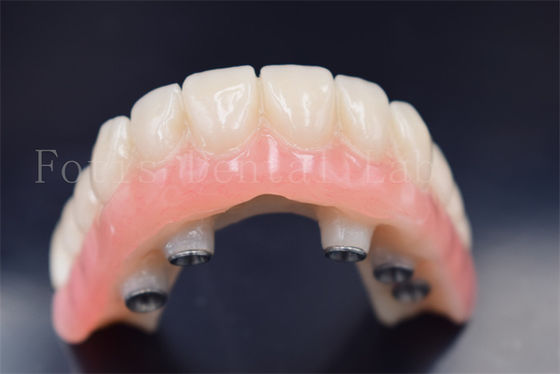 Good price Customized Dental Implants Crowns Replacement Wear Resistance online