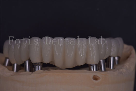 Good price Reliable Dental Implant Crowns For Comfort And Functionality online