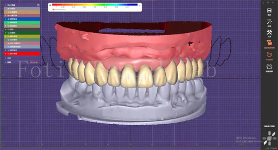 Good price Dental Teeth Design Service With Prosthesis Planning And Oral Implant Designs online