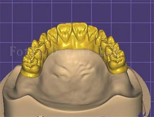 Good price Customization Innovative Dental Design For Enhanced Productivity And Profitability online