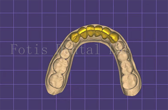 Good price Customizable Dental Mouth Model Maker Autoclavable FDA Approved online