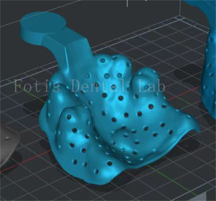Good price Customizable Dental Design Service Enamel Enhancement Program online