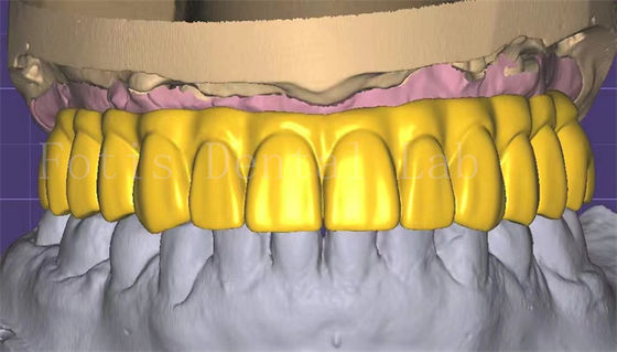 Good price Professional  3shape Crown Design Excellent Performance And Durability online