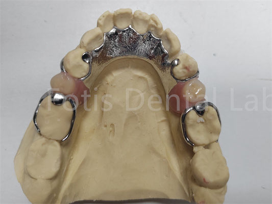 Good price Adjustable Co Cr Partial Denture Comfortable Dental Prosthesis For Missing Teeth online