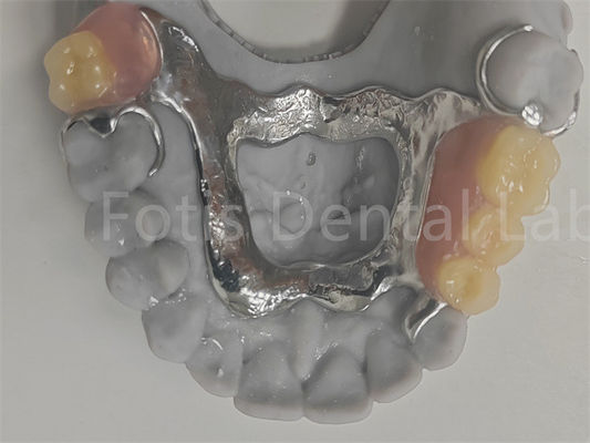 Good price FDA Easy To Clean Removable Partial Denture Compatible With Natural Teeth online