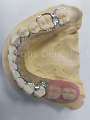 Good price Replace Missing Teeth Removable Partial Denture Dental Prosthesis Flexible Design online