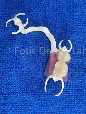Good price Customizable Comfortable Removable Partial Denture For Stable Teeth Replacement online