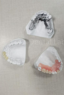 Good price Long Lasting Flexible Removable Partial Denture Easy Cleaning Replace Missing Teeth online
