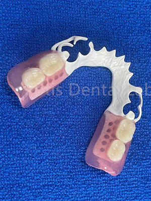 Good price Adjustable Flexible Dental Prosthesis Stable Comfortable Immediate Partial Denture online