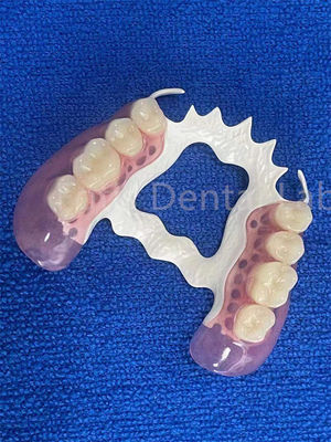 Good price Stain Resistant Removable Dental Partials Stable Replace Missing Teeth Prosthesis online