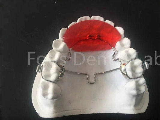Good price Durable Orthodontic Retainer Expander Comfortable And Convenient Wear online
