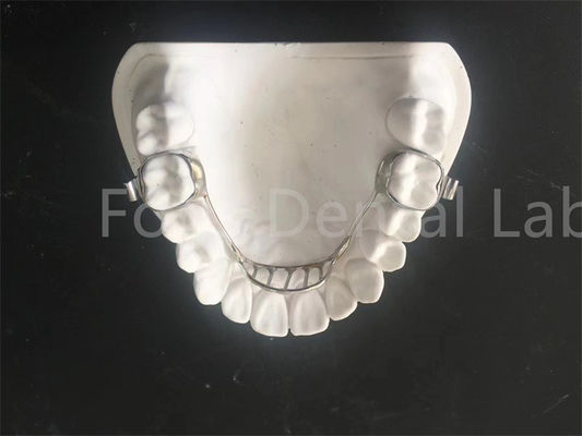 Good price Customizable Expanding Retainer Palatal Expander Retainer Easy Maintenance online