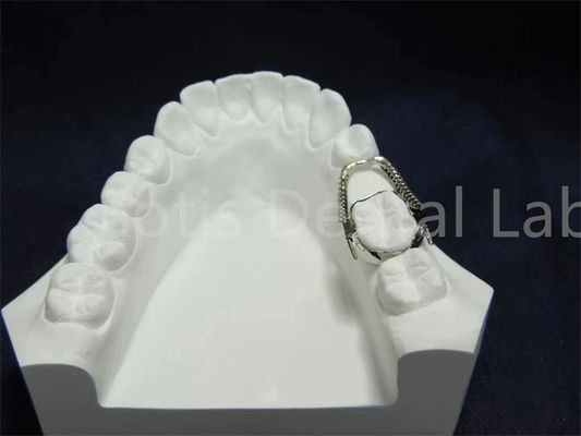 Good price Adjustable Retainer Expander Convenient Orthodontic Solution Easy Maintenance online