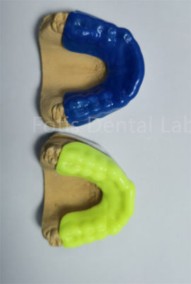 Good price Advanced Orthodontic Retainer Expander For Precise And Comfortable Treatment online
