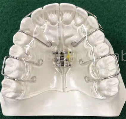 Good price State-Of-The-Art Orthodontics Appliance Expanding Retainer Customizable online