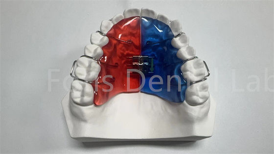 Good price Individual Orthodontic Expander For Dental Correction And Improvement online