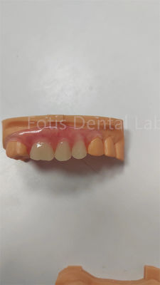 Good price Durable TCS Flexible Partial Valplast Flexible Dentures Stain Resistant online