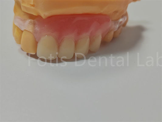 Good price FDA/ISO Certification TCS Valplast Flexible Dentures Easy To Clean Adjust online