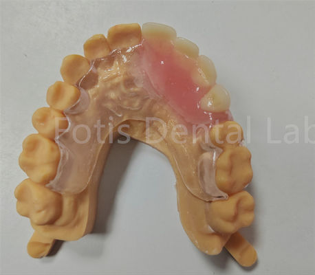Good price Hypoallergenic Comfort Fit Flexible Valplast Partial TCS Dental Appliance online