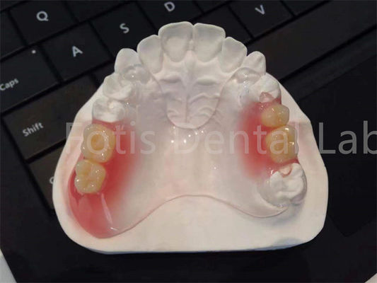 Good price Flexible TCS Valplast Dental Appliances Comfortable Durable Design online