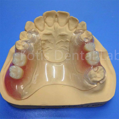 Good price Easy To Clean And Adjust Partial Dental Prosthesis Durable Comfortable online