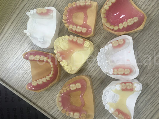 Good price Flexible TCS Valplast Removable Partial Denture Easy To Adjust online