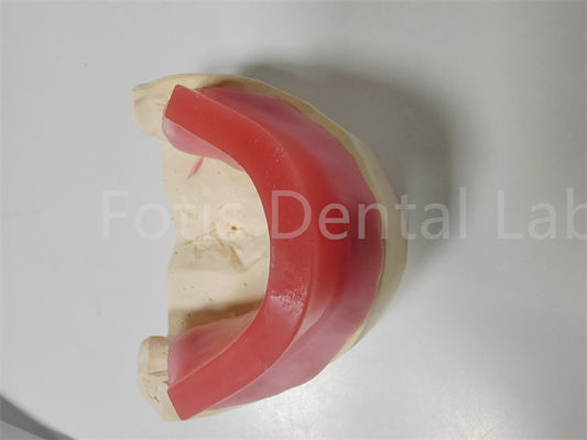 Good price Customized Bite Rims For Dentures Dual Bite Rims Set Jaw Occluding Relation online