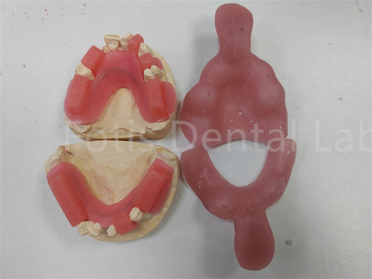 Good price Vibrant Red Bite Rims For Upper Or Lower Teeth Glossy Finish Lightweight Lbs online