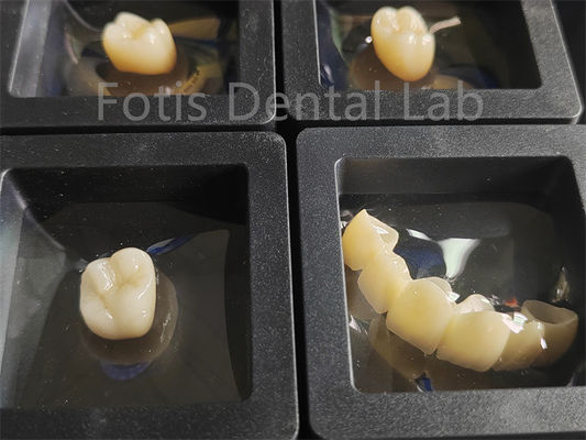 Good price Dental Restorations Zirconia Multilayer Fracture Resistance online