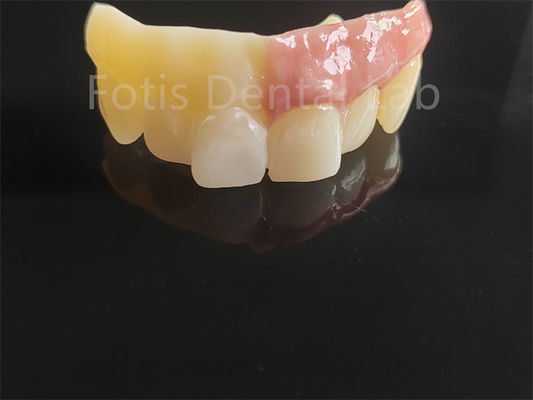 Good price Monolithic Zirconia Layered With Porcelain Computer Aided Design online
